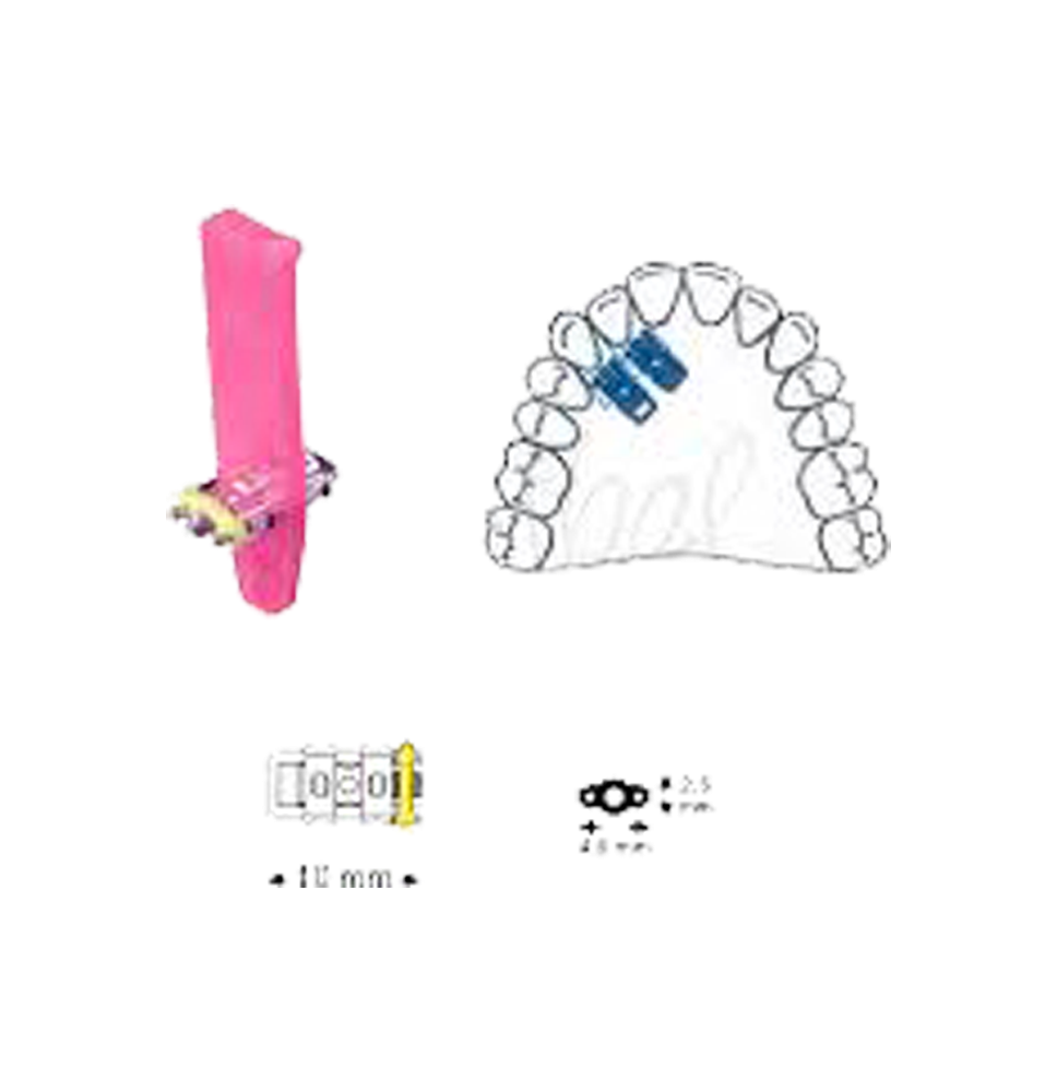 LEONE LEONE TORNILLO EXPANSIÓN SUPER MICRO MONOLATERAL 10uds